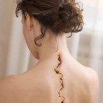 Woman with a crack in her back